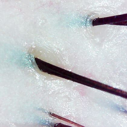 綺麗になった毛穴